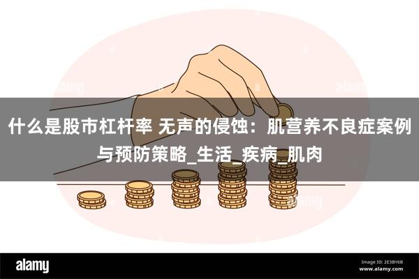 什么是股市杠杆率 无声的侵蚀：肌营养不良症案例与预防策略_生活_疾病_肌肉